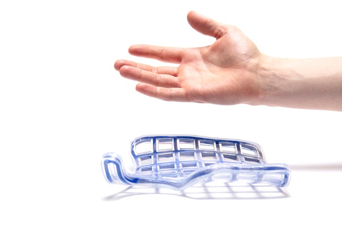 healthcare, innovation, reversible fixation, shape memory, shape memory material, reflex, re:flex, arm cast, design, reshape, reuse, recycle